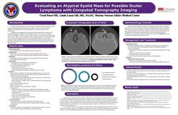 Evaluating an Atypical Eyelid Mass for Possible Ocular Lymphoma with Computed Tomography Imaging